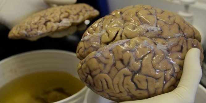 Un scientifique manipule un cerveau